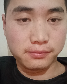 矫善本